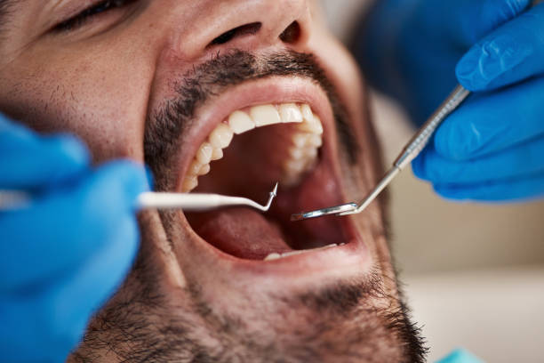 Best Dental Exams and Cleanings  in Bluffton, IN